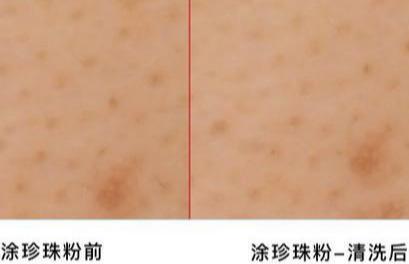 珍珠美白层粉_珍珠粉美白骗局_珍珠粉美白是骗局吗